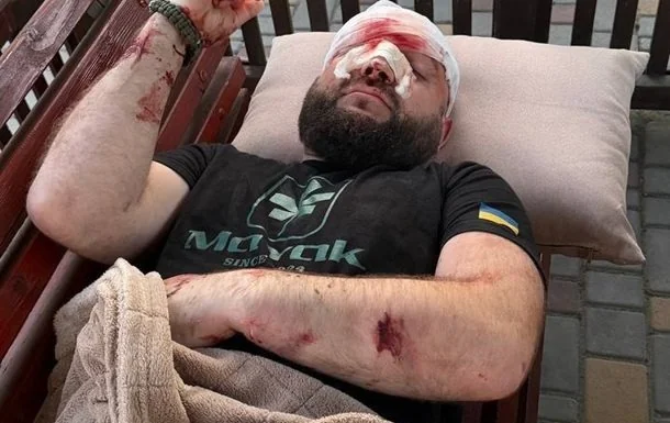 Поранений ветеран АТО з Одеської області після нападу арматурою в Затоці